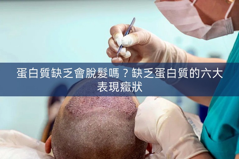 蛋白質缺乏會脫髮嗎？缺乏蛋白質的六大表現癥狀