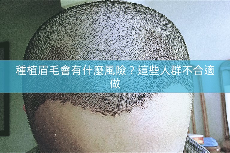 種植眉毛會有什麼風險？這些人群不合適做