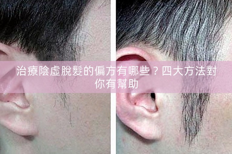 治療陰虛脫髮的偏方有哪些？四大方法對你有幫助