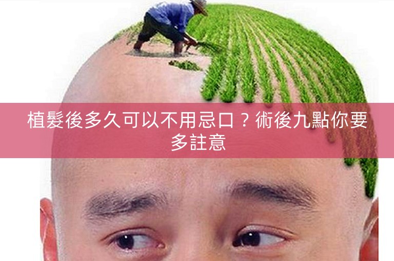 植髮後多久可以不用忌口？術後九點你要多註意