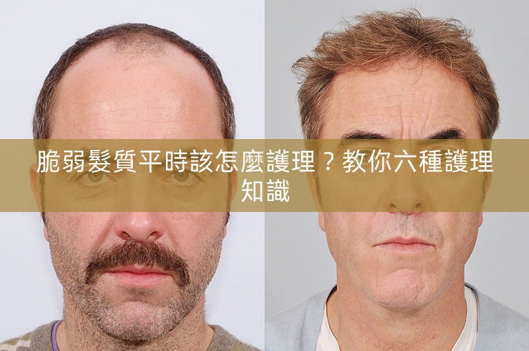 脆弱髮質平時該怎麼護理？教你六種護理知識