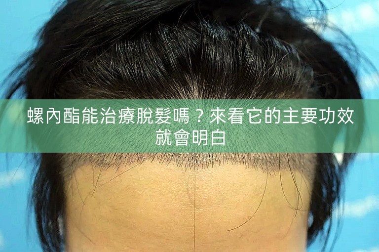 螺內酯能治療脫髮嗎?來看它的主要功效就會明白 螺內酯能治療脫髮嗎?來看它的主要功效就會明白