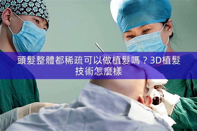 頭髮整體都稀疏可以做植髮嗎？3D植髮技術怎麼樣
