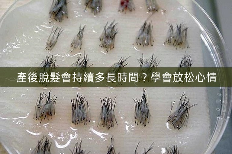 產後脫髮會持續多長時間？學會放松心情