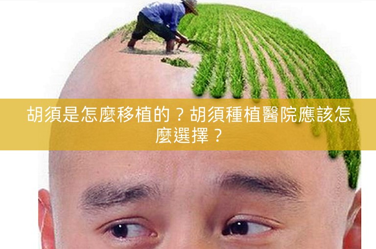 胡須是怎麼移植的?胡須種植醫院應該怎麼選擇? 胡須是怎麼移植的?胡須種植醫院應該怎麼選擇?