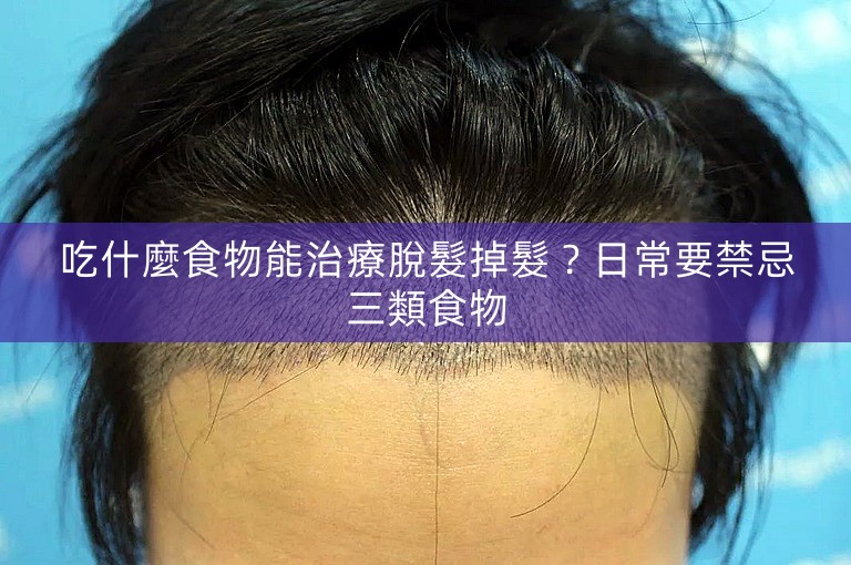 吃什麼食物能治療脫髮掉髮？日常要禁忌三類食物