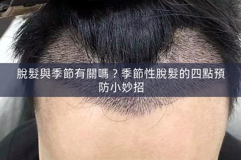脫髮與季節有關嗎？季節性脫髮的四點預防小妙招