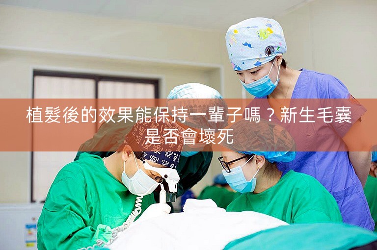 植髮後的效果能保持一輩子嗎？新生毛囊是否會壞死