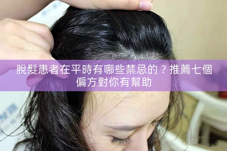 脫髮患者在平時有哪些禁忌的?推薦七個偏方對你有幫助 脫髮患者在平時有哪些禁忌的?推薦七個偏方對你有幫助