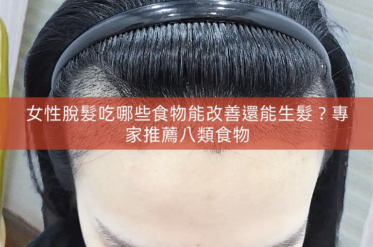 女性脫髮吃哪些食物能改善還能生髮？專家推薦八類食物