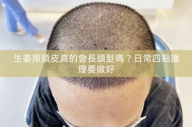 生姜擦頭皮真的會長頭髮嗎？日常四點護理要做好