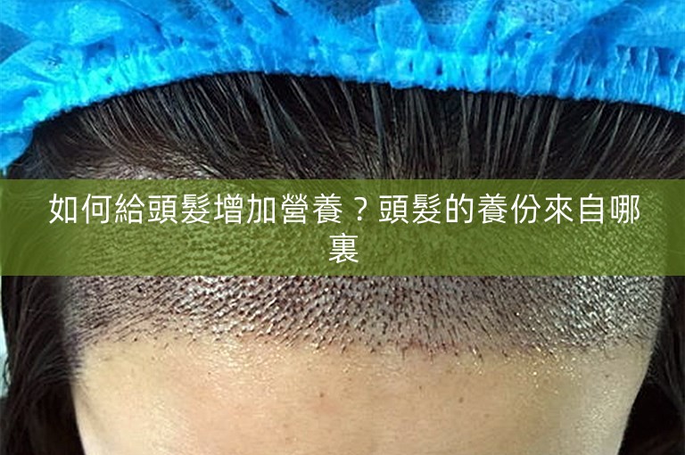 如何給頭髮增加營養?頭髮的養份來自哪裏 如何給頭髮增加營養?頭髮的養份來自哪裏