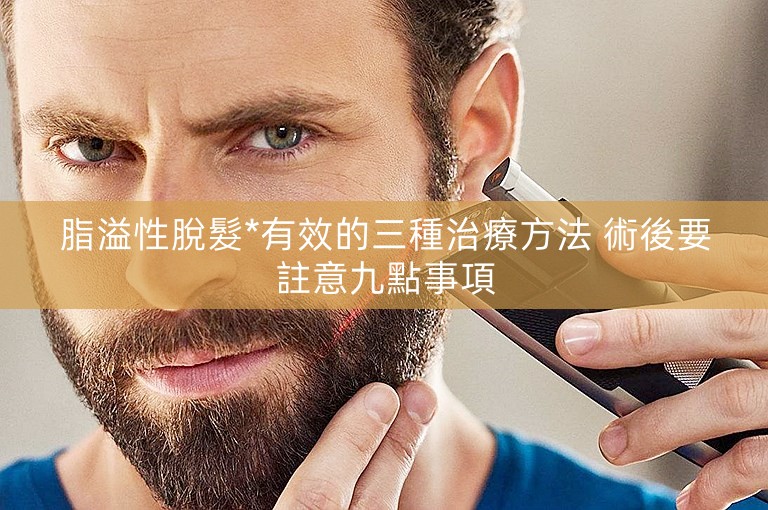 脂溢性脫髮*有效的三種治療方法 術後要註意九點事項