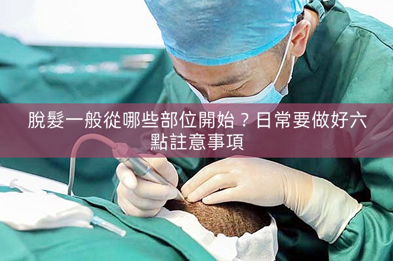 脫髮一般從哪些部位開始？日常要做好六點註意事項