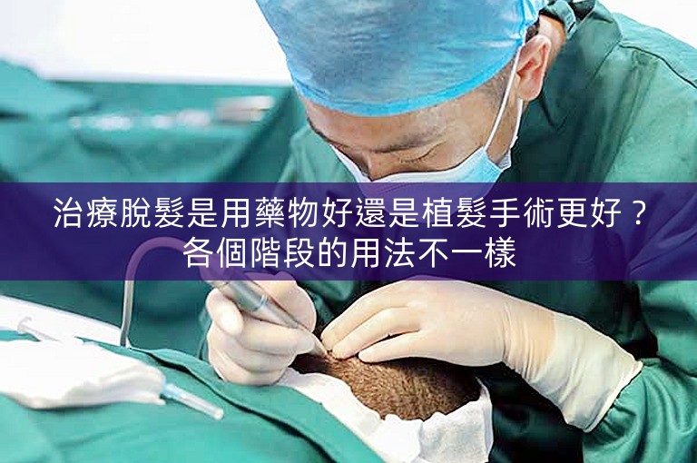 治療脫髮是用藥物好還是植髮手術更好？各個階段的用法不一樣