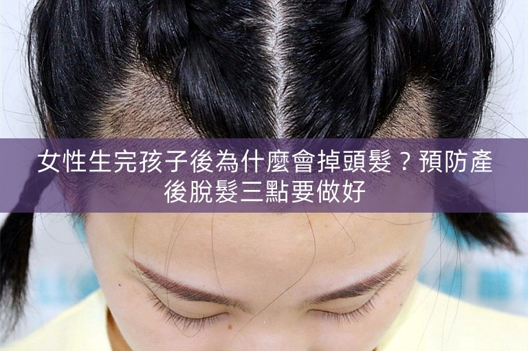 女性生完孩子後為什麼會掉頭髮？預防產後脫髮三點要做好