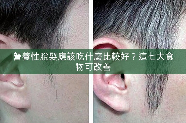 營養性脫髮應該吃什麼比較好？這七大食物可改善