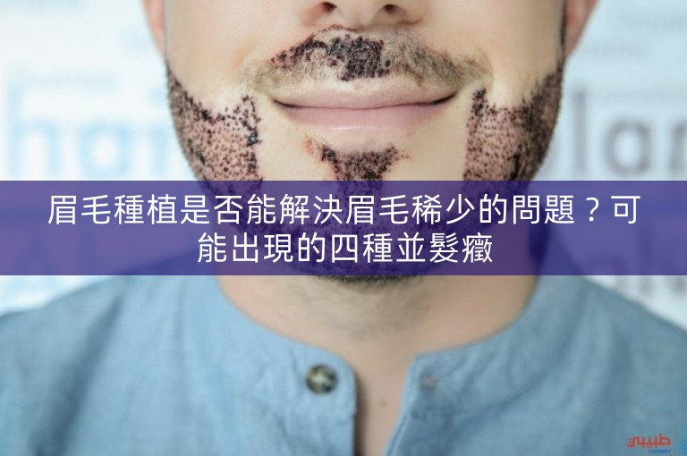 眉毛種植是否能解決眉毛稀少的問題？可能出現的四種並髮癥