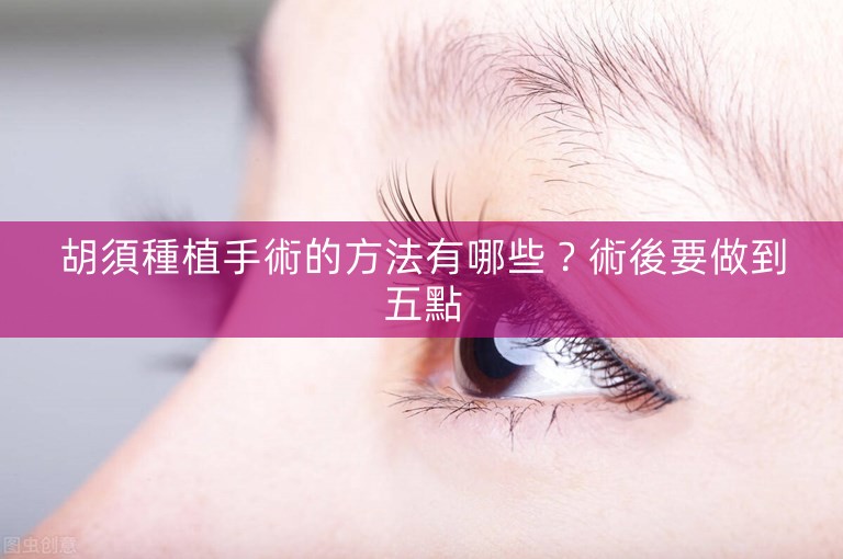 胡須種植手術的方法有哪些?術後要做到五點 胡須種植手術的方法有哪些?術後要做到五點