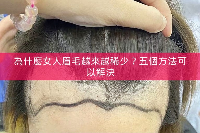 為什麼女人眉毛越來越稀少？五個方法可以解決