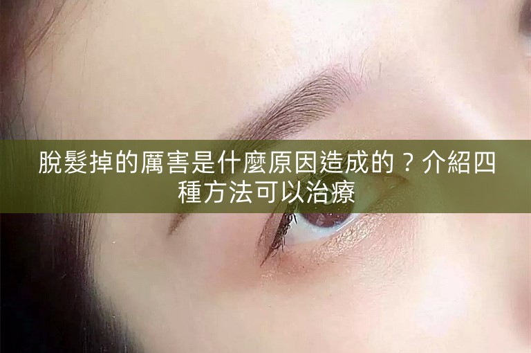 脫髮掉的厲害是什麼原因造成的？介紹四種方法可以治療