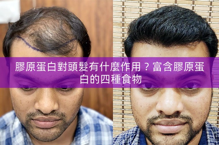 膠原蛋白對頭髮有什麼作用？富含膠原蛋白的四種食物