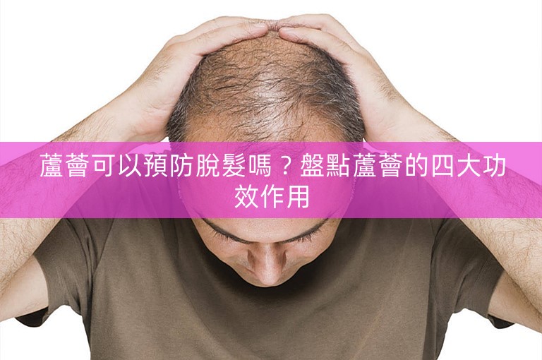 蘆薈可以預防脫髮嗎？盤點蘆薈的四大功效作用