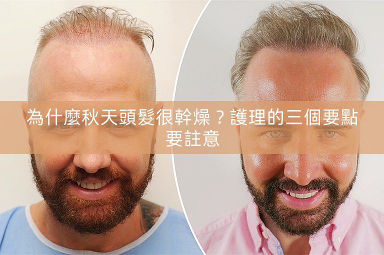 為什麼秋天頭髮很幹燥？護理的三個要點要註意