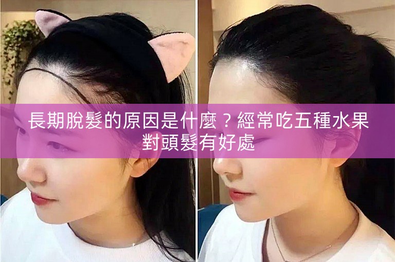 長期脫髮的原因是什麼？經常吃五種水果對頭髮有好處