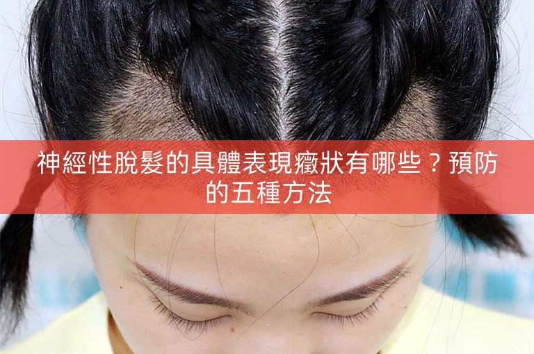 神經性脫髮的具體表現癥狀有哪些？預防的五種方法