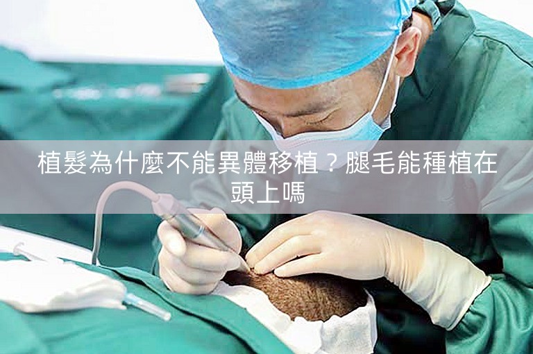 植髮為什麼不能異體移植?腿毛能種植在頭上嗎 植髮為什麼不能異體移植?腿毛能種植在頭上嗎