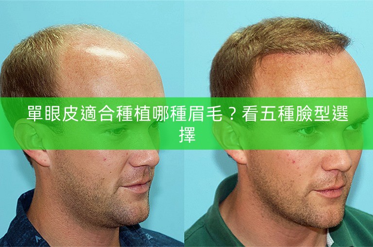 單眼皮適合種植哪種眉毛?看五種臉型選擇 單眼皮適合種植哪種眉毛?看五種臉型選擇