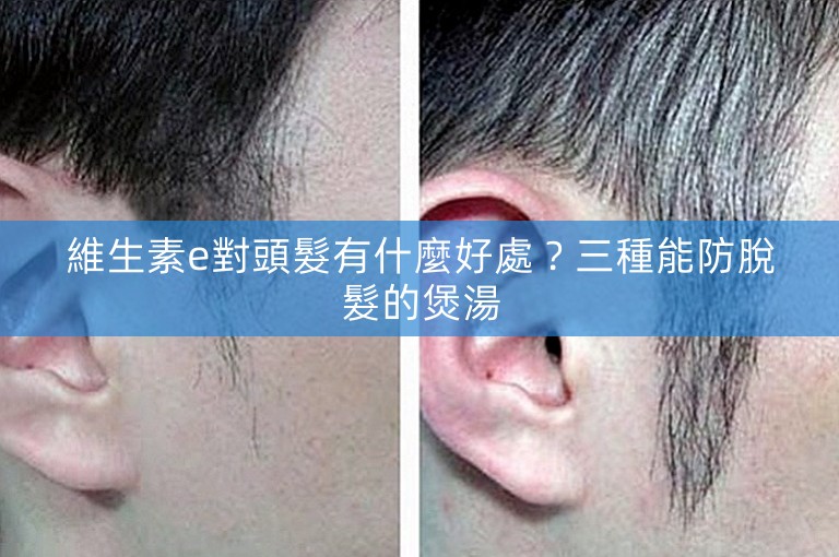 維生素e對頭髮有什麼好處？三種能防脫髮的煲湯