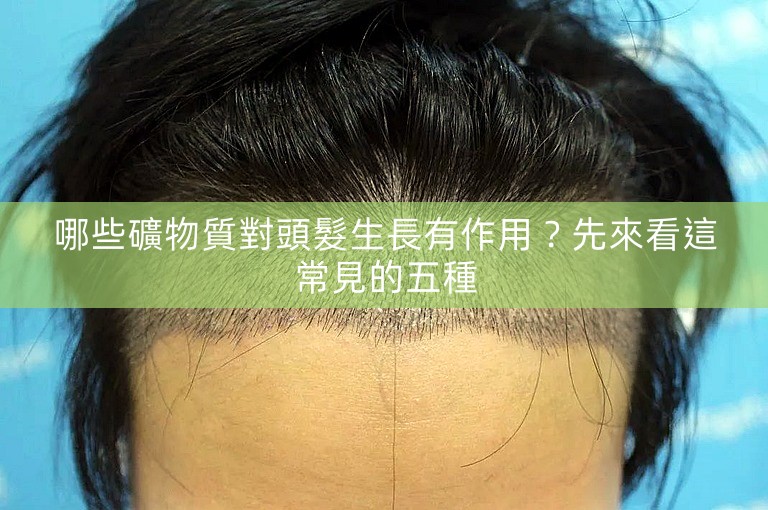 哪些礦物質對頭髮生長有作用？先來看這常見的五種