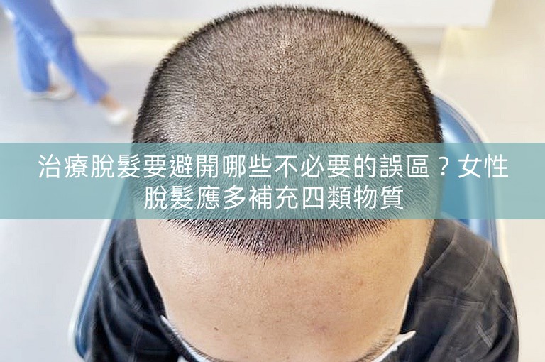 治療脫髮要避開哪些不必要的誤區？女性脫髮應多補充四類物質