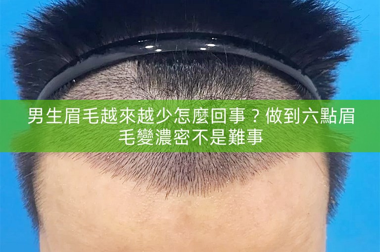 男生眉毛越來越少怎麼回事?做到六點眉毛變濃密不是難事 男生眉毛越來越少怎麼回事?做到六點眉毛變濃密不是難事