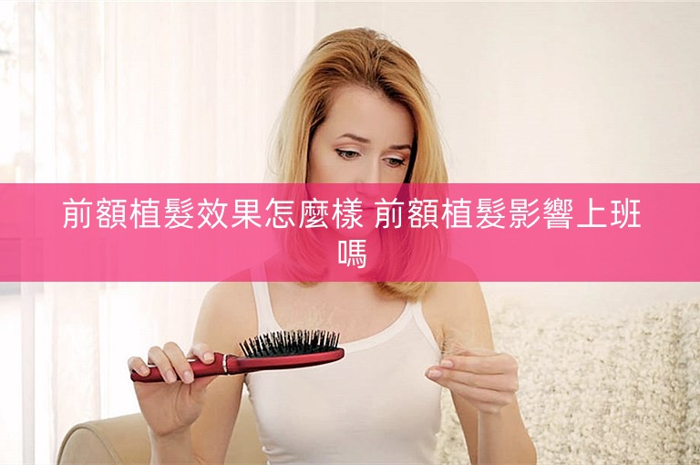 前額植髮效果怎麼樣 前額植髮影響上班嗎