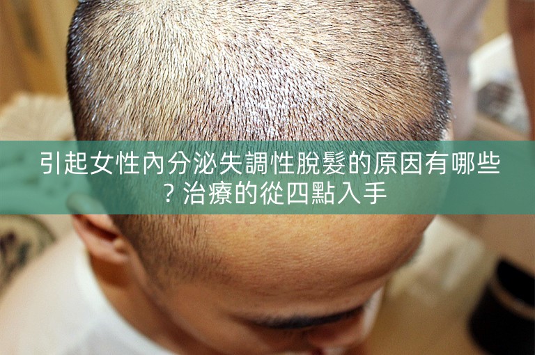 引起女性內分泌失調性脫髮的原因有哪些？治療的從四點入手