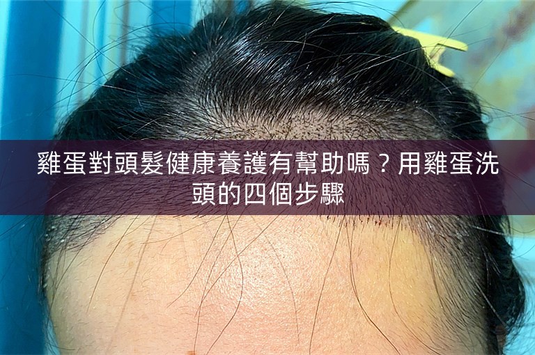 雞蛋對頭髮健康養護有幫助嗎？用雞蛋洗頭的四個步驟