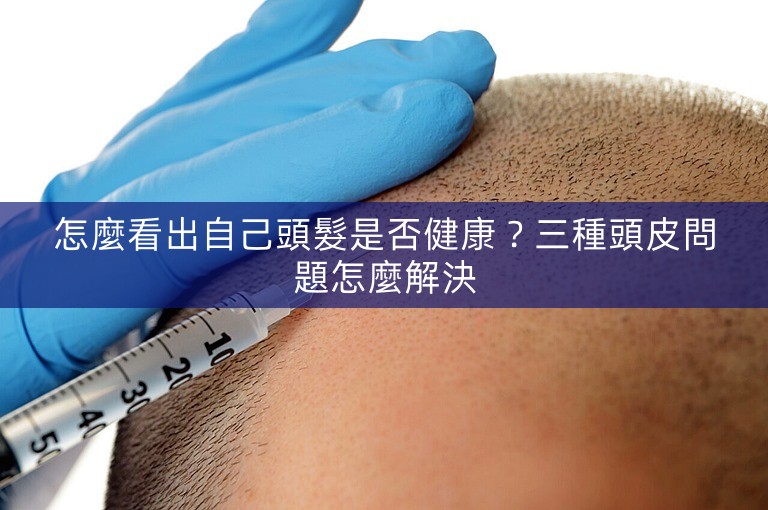 怎麼看出自己頭髮是否健康？三種頭皮問題怎麼解決
