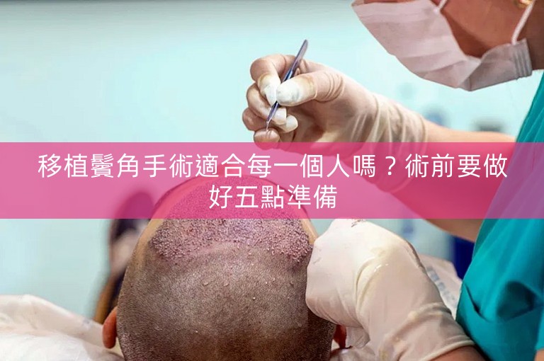 移植鬢角手術適合每一個人嗎？術前要做好五點準備