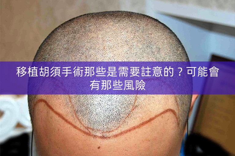 移植胡須手術那些是需要註意的？可能會有那些風險