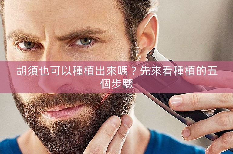胡須也可以種植出來嗎？先來看種植的五個步驟