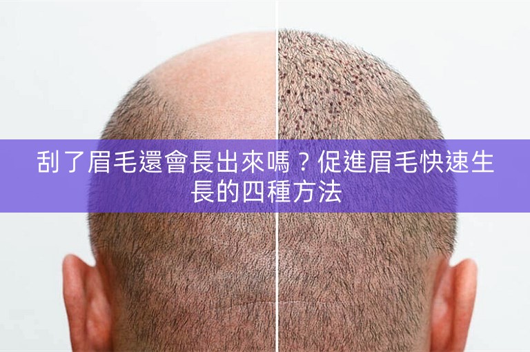 刮了眉毛還會長出來嗎?促進眉毛快速生長的四種方法 刮了眉毛還會長出來嗎?促進眉毛快速生長的四種方法