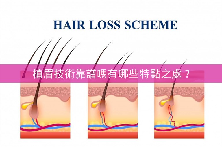 植眉技術靠譜嗎有哪些特點之處？