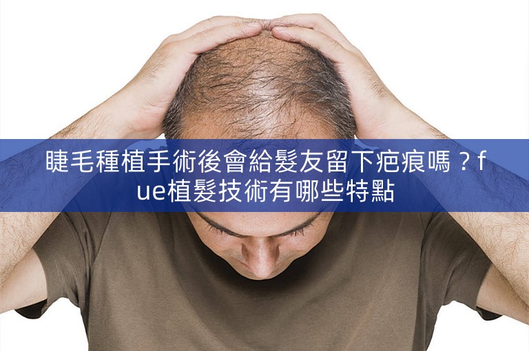 睫毛種植手術後會給髮友留下疤痕嗎？fue植髮技術有哪些特點