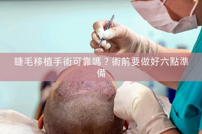 睫毛移植手術可靠嗎？術前要做好六點準備