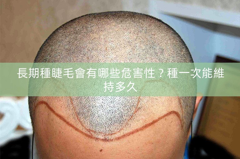 長期種睫毛會有哪些危害性?種一次能維持多久 長期種睫毛會有哪些危害性?種一次能維持多久