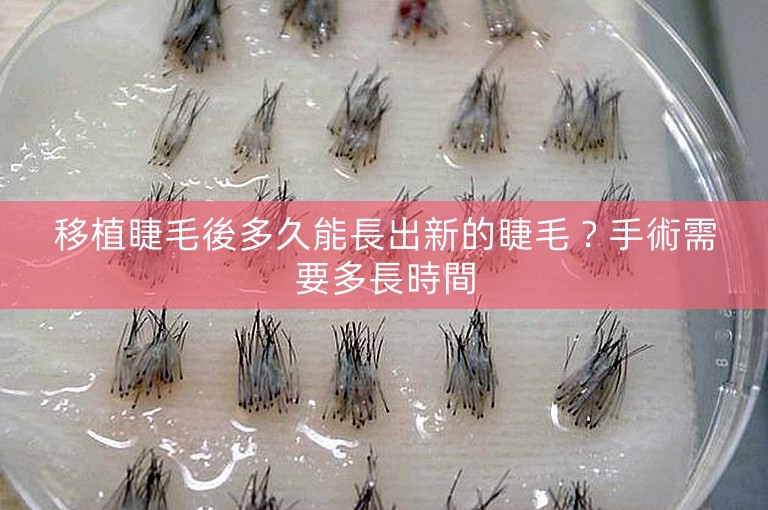 移植睫毛後多久能長出新的睫毛?手術需要多長時間 移植睫毛後多久能長出新的睫毛?手術需要多長時間