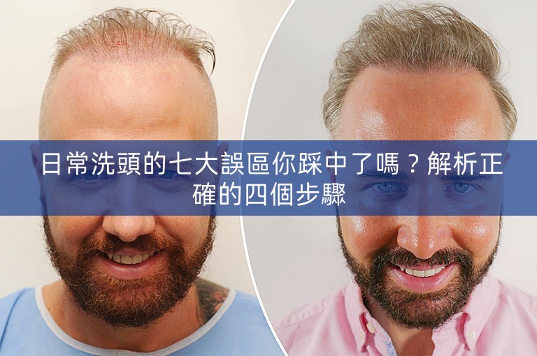 日常洗頭的七大誤區你踩中了嗎?解析正確的四個步驟 日常洗頭的七大誤區你踩中了嗎?解析正確的四個步驟